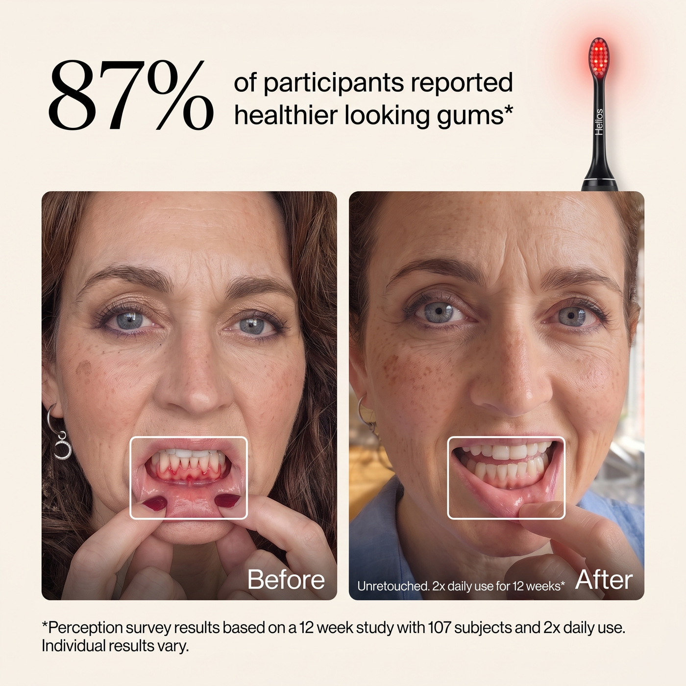 Helios Gum Recovery Pro Toothbrush