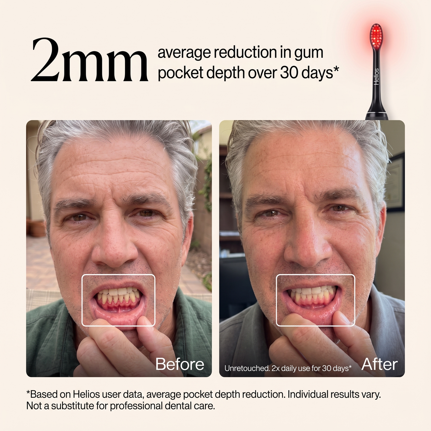 Helios Gum Recovery Pro Toothbrush