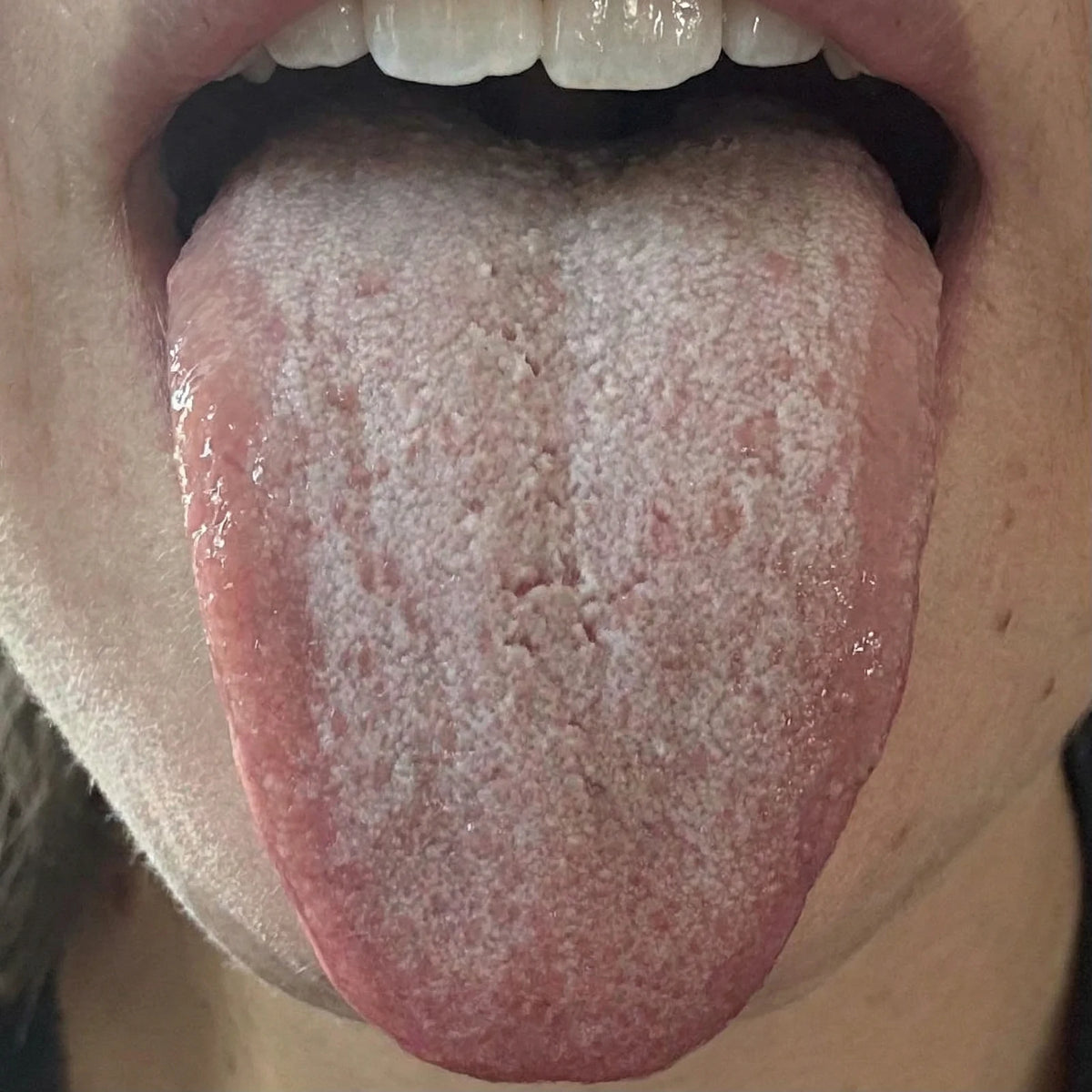 Cleaner, Fresher Mouth — Day 01