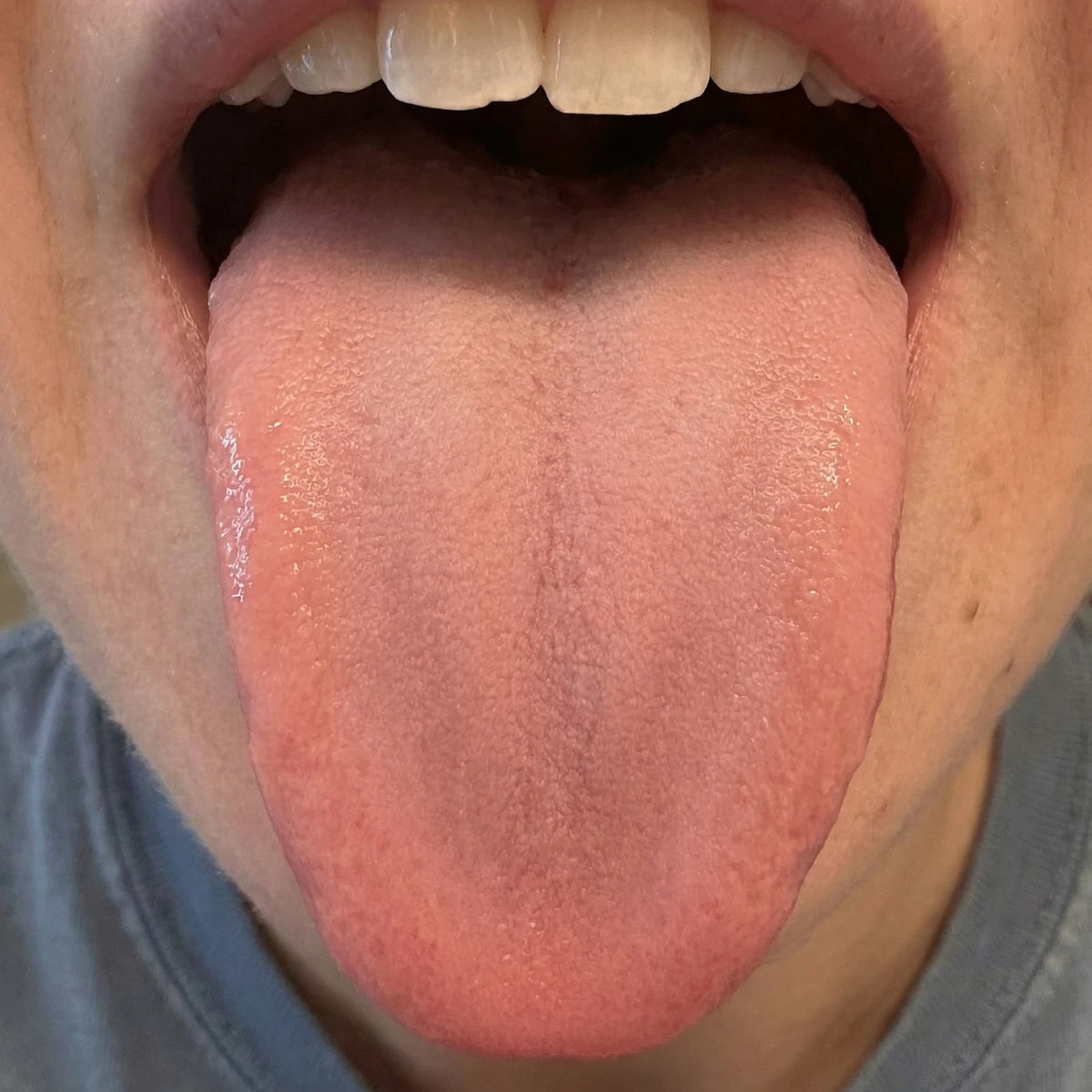 Cleaner, Fresher Mouth — Day 30