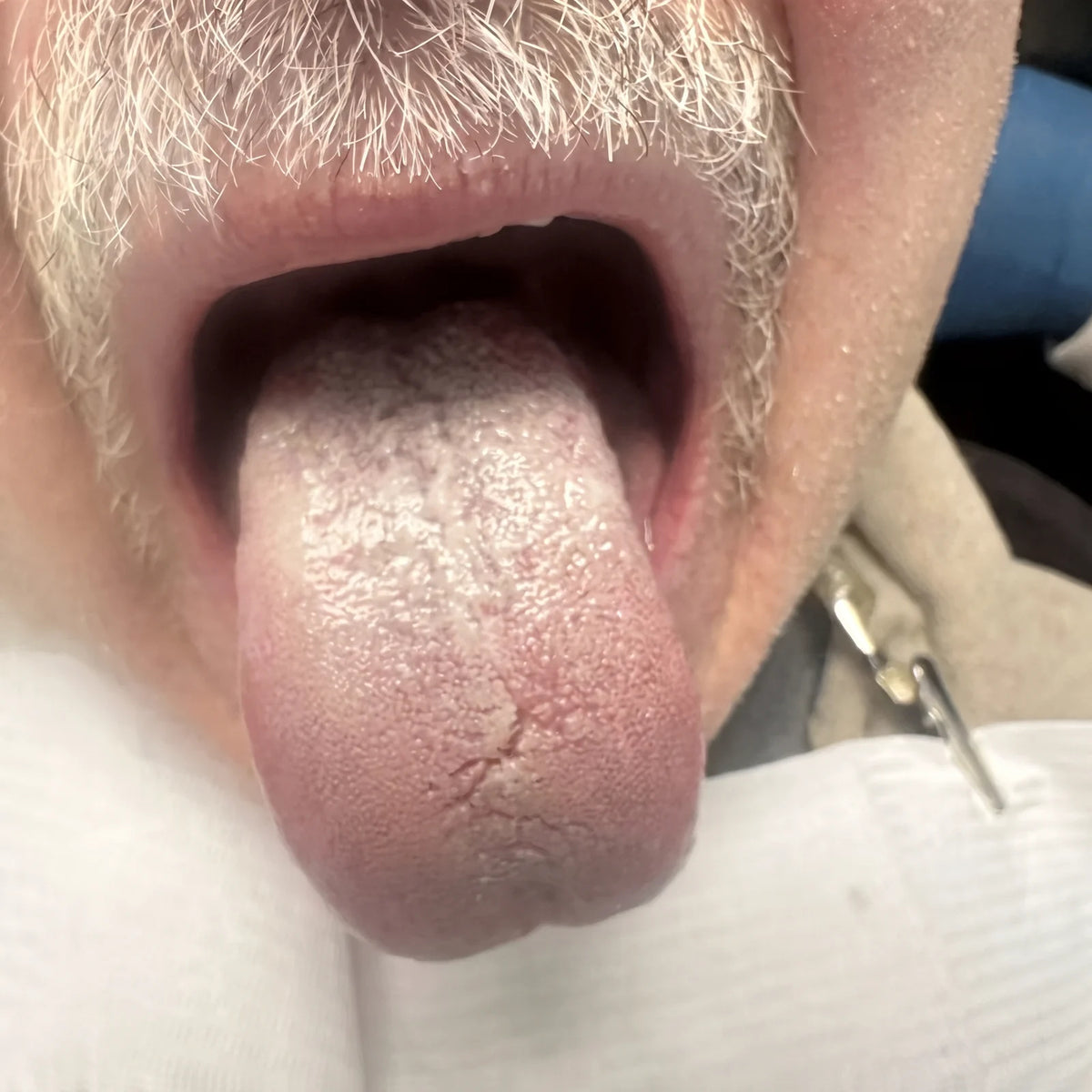 His Wife Noticed First — Day 01